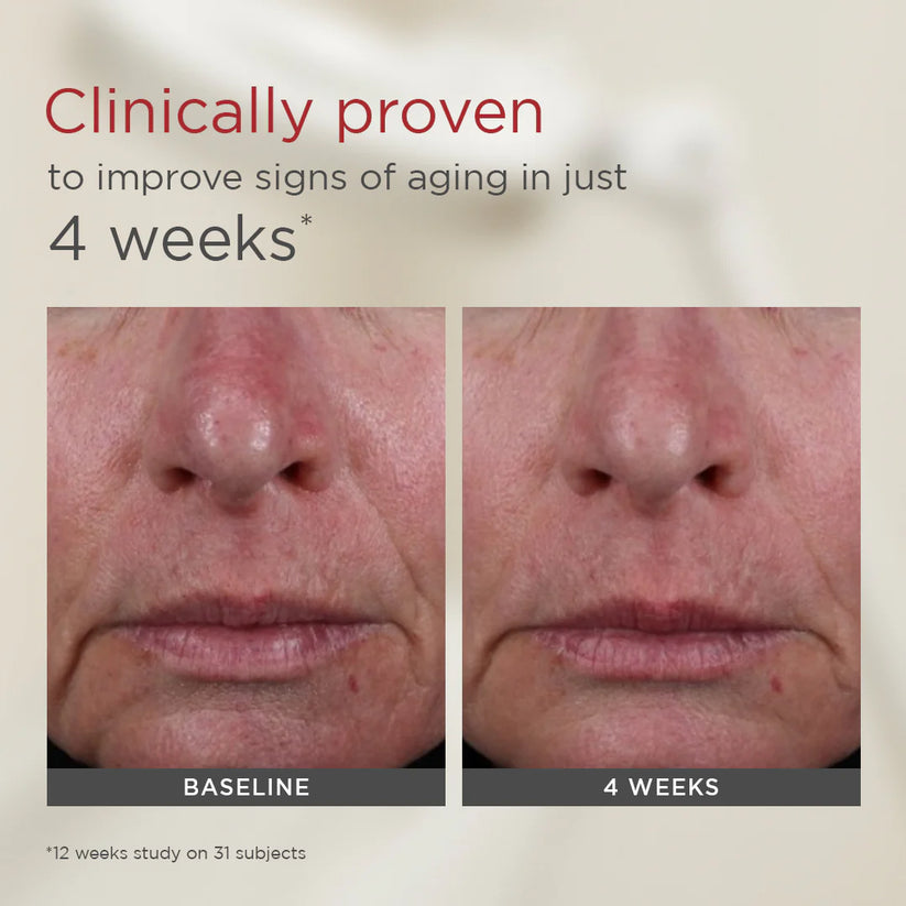 Before and after comparison of skin texture with text indicating clinical improvement in 4 weeks.