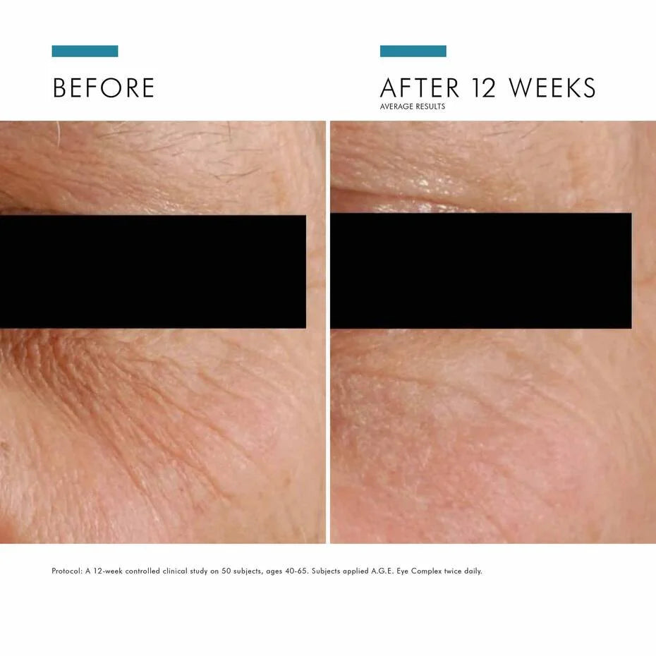 Before and after comparison of skin texture with text indicating results after 12 weeks.