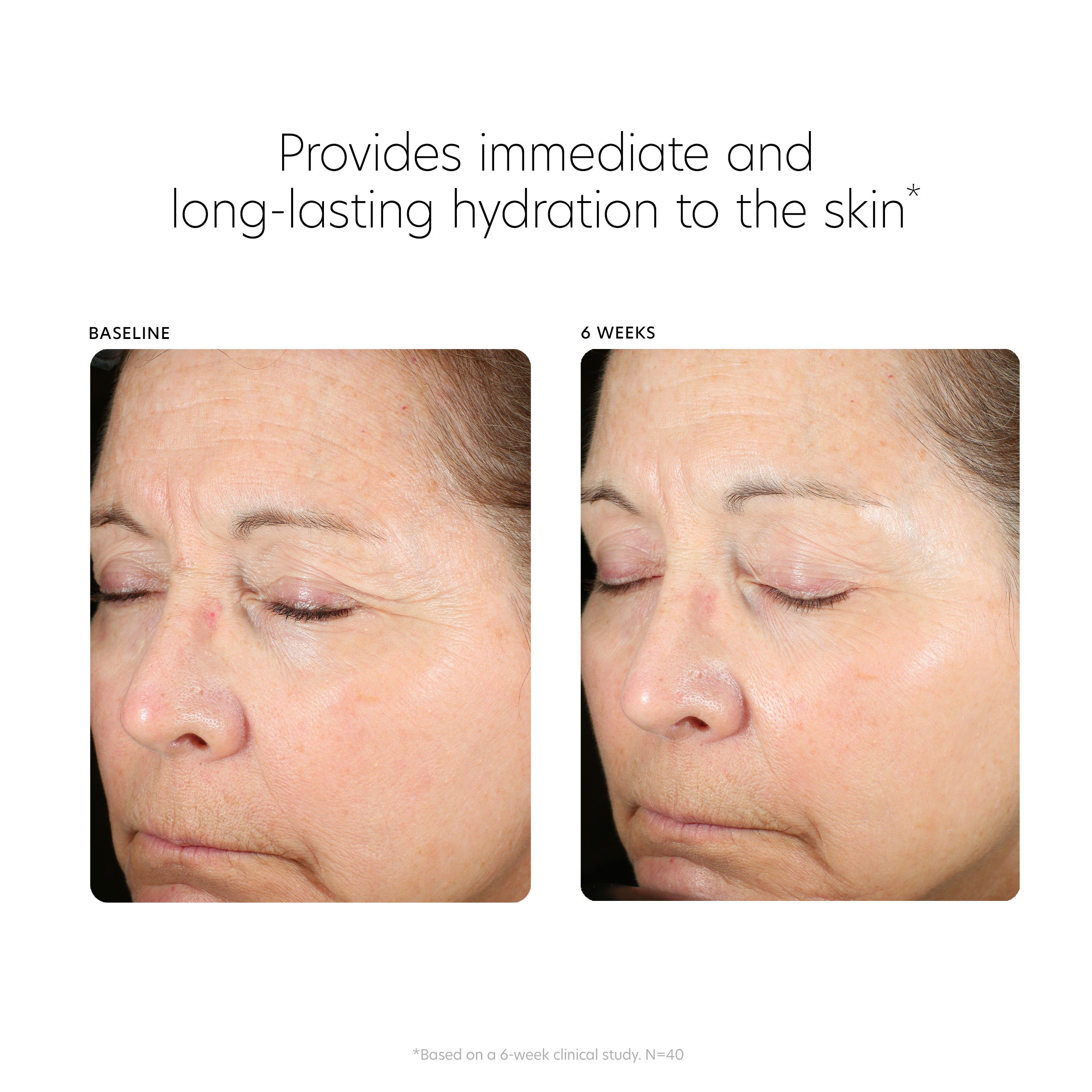 Before and after comparison of a woman's face with text indicating immediate and long-lasting hydration benefits.