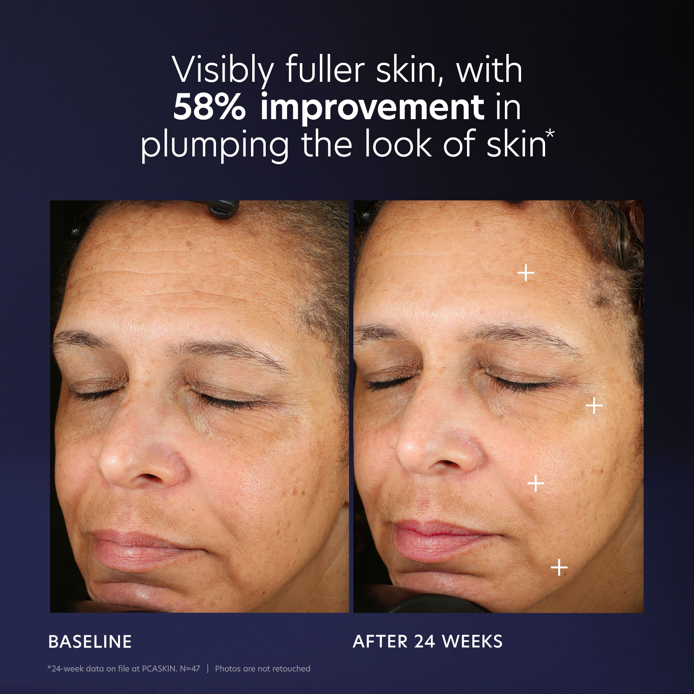 Before and after comparison of skin improvement with text indicating 58% improvement.
