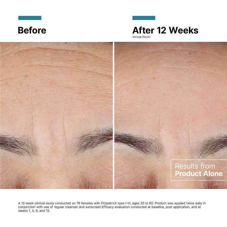 Before and after comparison of skin texture and hair growth on a person's face.