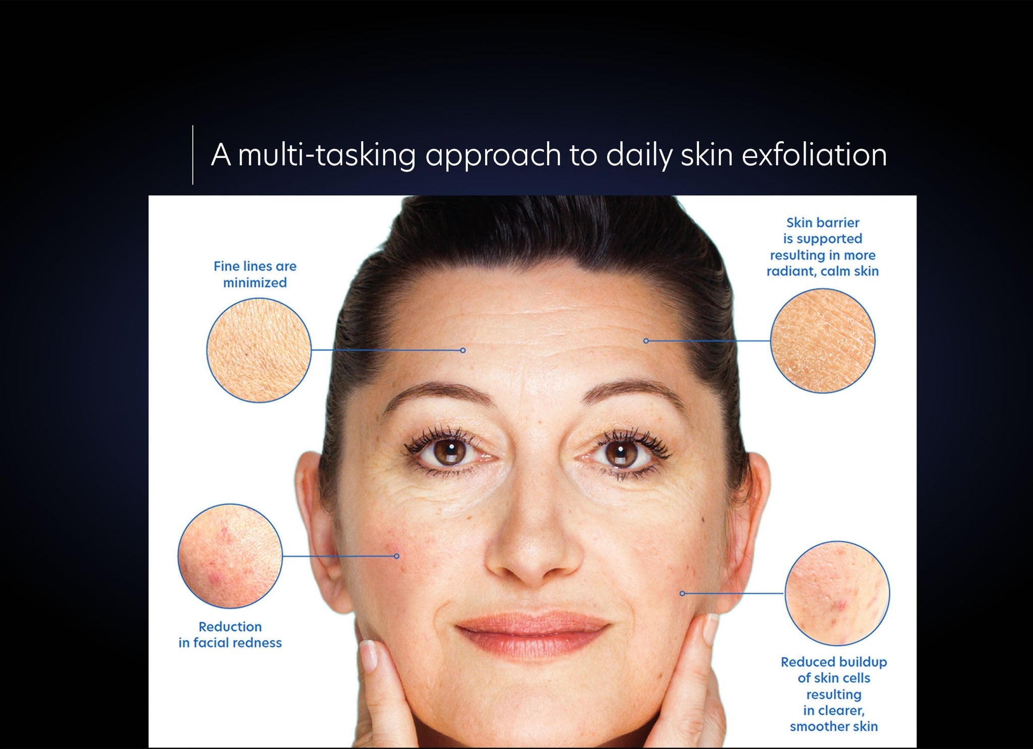 Woman's face with skin care benefits labeled on a dark background
