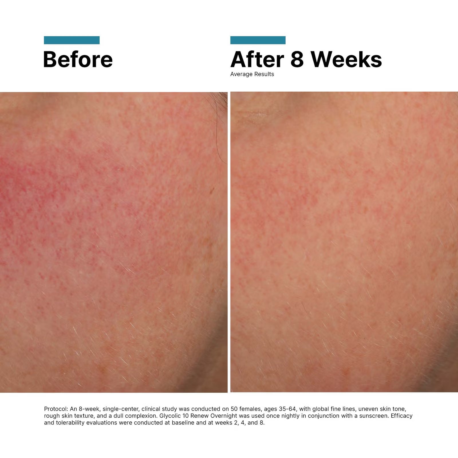 Glycolic 10 Renew Overnight